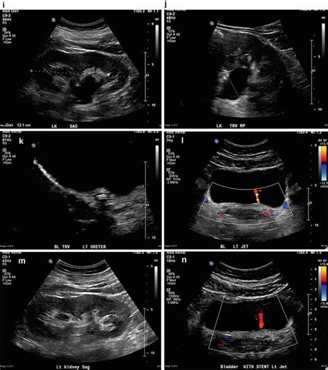 Penile Ultrasound | Radiology Key