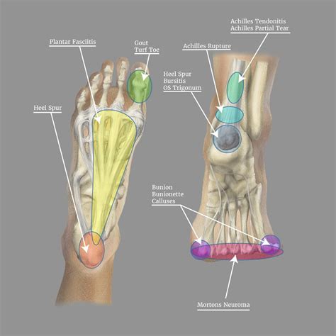 Hurt Your Ankle? Use Our Ankle Pain Symptom Checker Tool