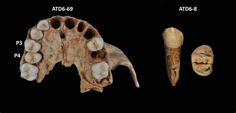 Neanderthals are not the only species whose dentition is characterized ...