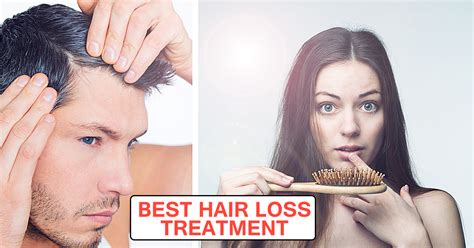 Best Hair Loss Treatment - A Lot Of Options( An Easy how to guide ) - Life Beauty place