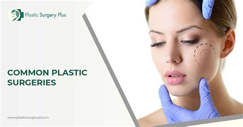 Knowing The Most Common Plastic Surgery Types