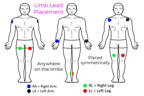 Proper Electrocardiogram (ECG/EKG) Lead Placement | ECGEDU