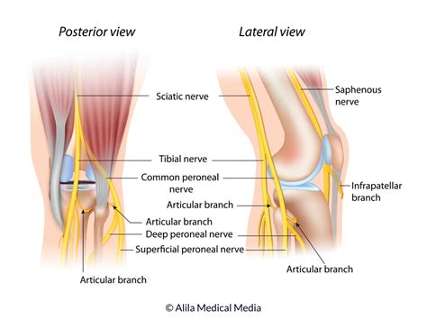 Knee Pain - Interventus