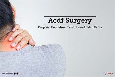 ACDF Surgery: Purpose, Procedure, Benefits and Side Effects