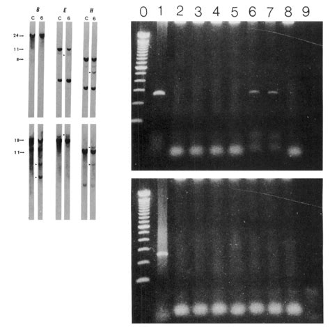 (Left) Southern blot analysis of the gene rearrangements in case 6. The... | Download Scientific ...