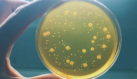 Common Beer Spoilage Bacteria