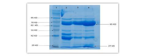 The SDS-PAGE for the purity at each stage in purification and... | Download Scientific Diagram