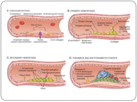 Stages Of Thrombus Formation – Beinyu.com