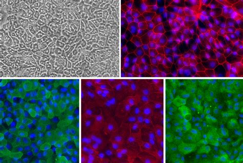 Human Intestinal Epithelial Cells: HInEpC | Cell Applications