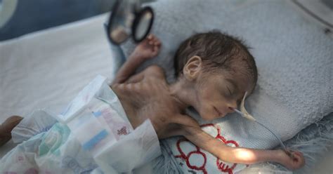 Millions of Yemeni children could starve amid pandemic, UNICEF says ...