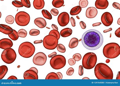 Iron deficiency anemia stock photo. Image of hematology - 129764588