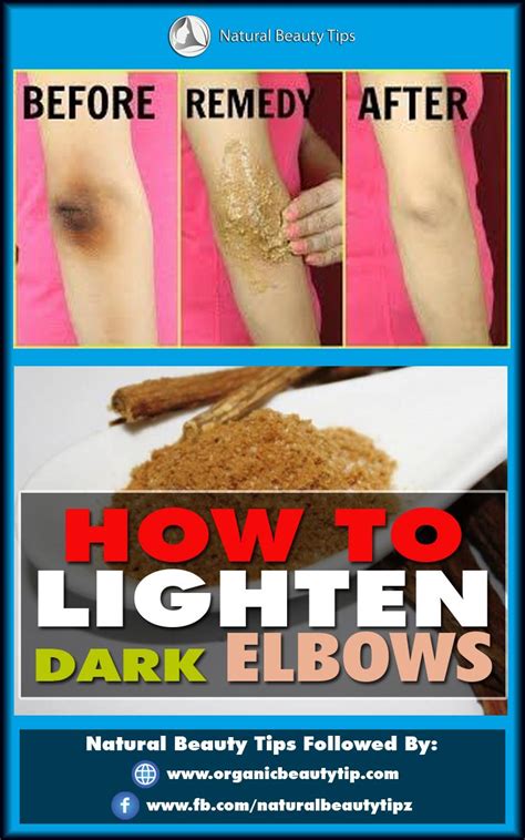 HOW TO LIGHTEN DARK ELBOWS | Natural beauty tips, Dark elbows, Lightening