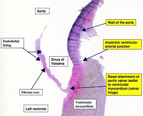 Atrioventricular Valve Histology