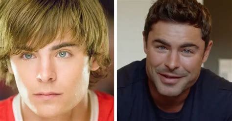 Zac Efron Reveals The Painful Reason Behind His Changed Jawline