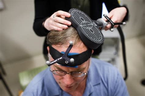 Tracking the risks and rewards of transcranial magnetic stimulation - The Boston Globe