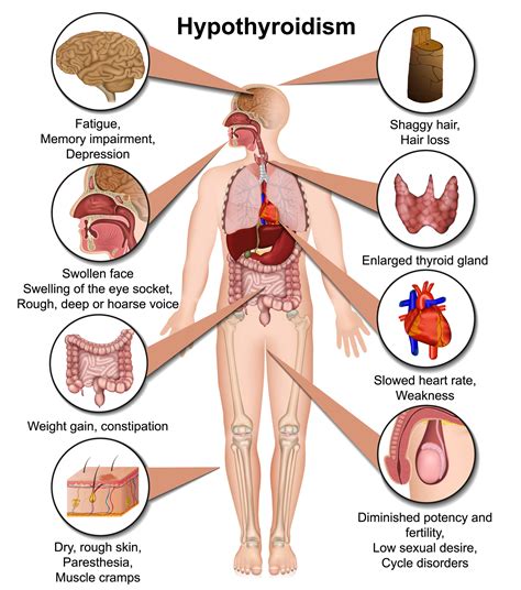 Signs Of Common Hormonal Imbalances In Men