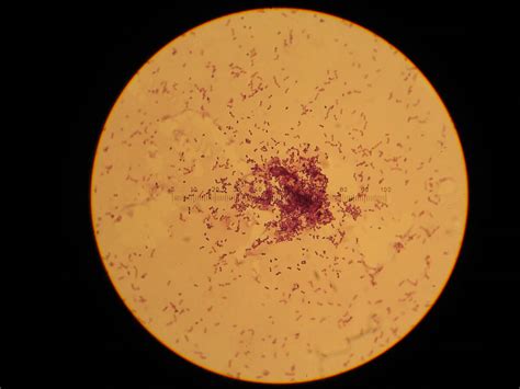 Streptococcus Lactis Under Microscope