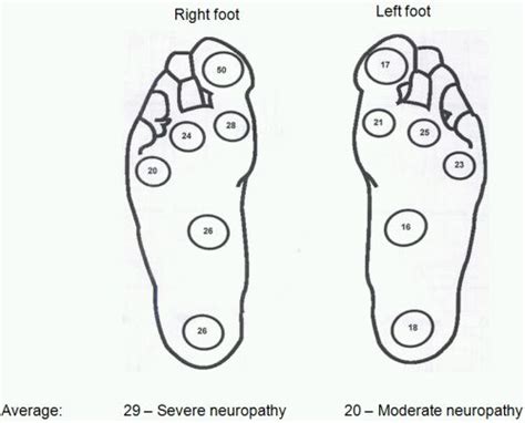 Diabetic foot screening « PG Blazer