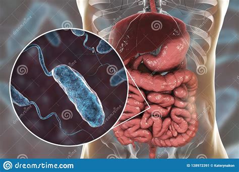 Vibrio Cholerae Bacteria in Small Intestine Stock Illustration ...