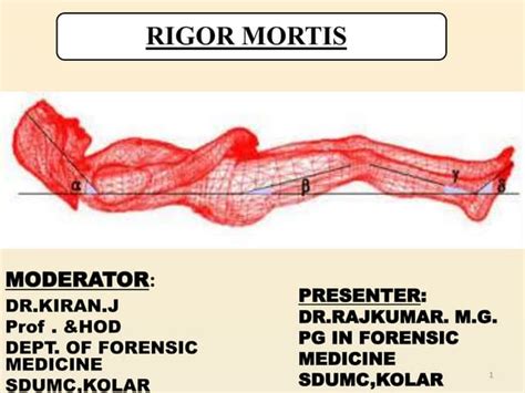 RIGOR MORTIS by rajkumar malur | PPT