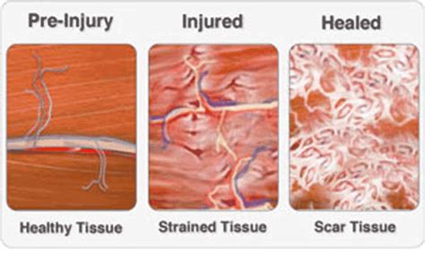 Anne: How to get Pregnant with Scar Tissue