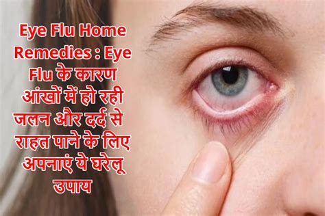 Eye Flu Home Remedies: आंखों में जलन होने पर करें ये नुस्खे