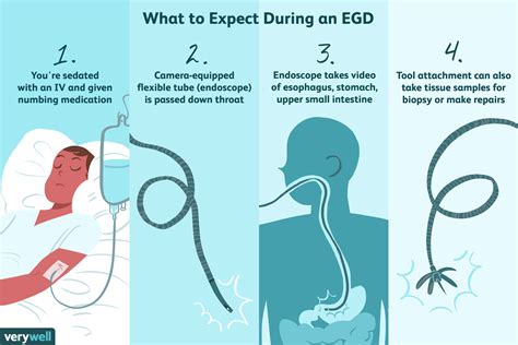 EGD: An Endoscopy to Check the Upper GI Tract