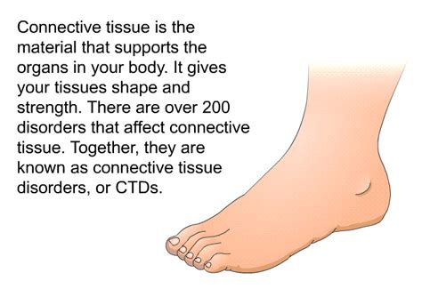 PatEdu.com : Connective Tissue Disorders or CTDs