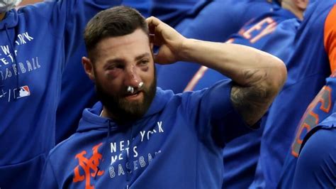 Mets' Kevin Pillar suffers multiple nasal fractures after taking fastball to face | CBC Sports