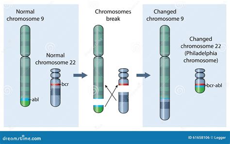 Philadelphia Chromosome Karyotype Stock Illustration | CartoonDealer ...