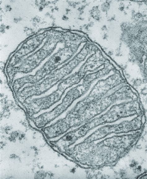 Electron Micrograph Of Mitochondria Labelled