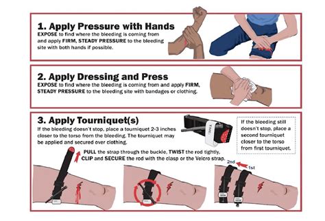 Learn How To Control Bleeding: Stop The Bleed Tutorial - VIGILINT