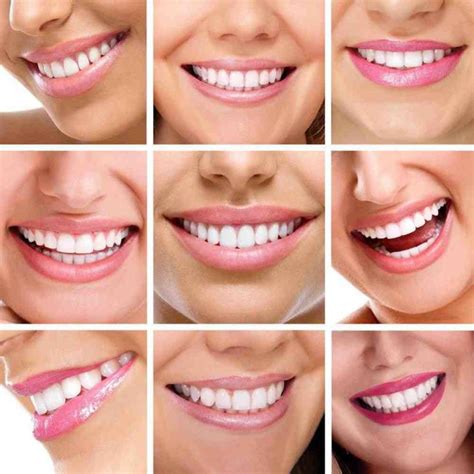 Cosmetic dentistry front teeth crowns - Dental News Network