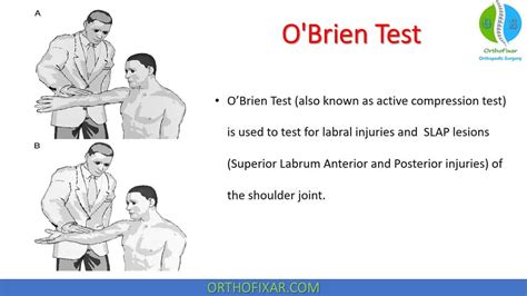 Bragard Test • Easy Explained - OrthoFixar 2022