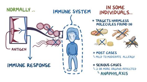 Anaphylaxis: Video, Anatomy, Definition & Function | Osmosis