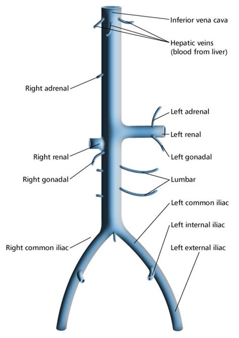 inferior vena cava syndrome - ModernHeal.com