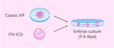 Types of fertilization and embryo culture