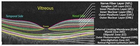 A novel automated method for the objective quantification of Retinal ...