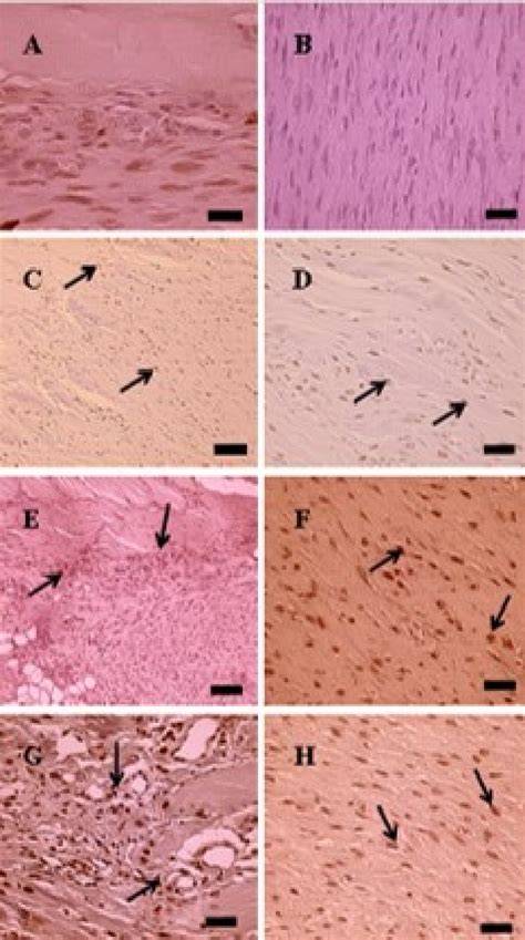 Histology of the longitudinal section of the Achilles tendon. The... | Download Scientific Diagram