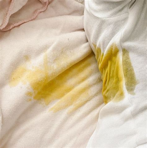 How To Remove Poop Stains From Baby's Clothes - Mother and Baby Love