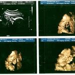 Baby Boy Scans | Flickr - Photo Sharing!