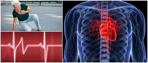 Fibrilación Auricular: Definición, Tipos, Síntomas, Diagnóstico, Causas y Tratamientos - Arriba ...