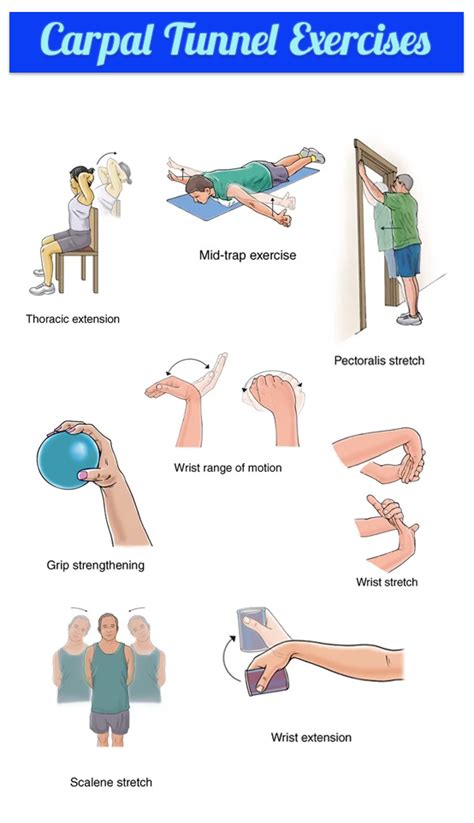 Carpal Tunnel Syndrome Stretches