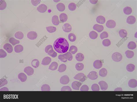 Red Blood Cells Form Microcytosis. Stock Photo & Stock Images | Bigstock