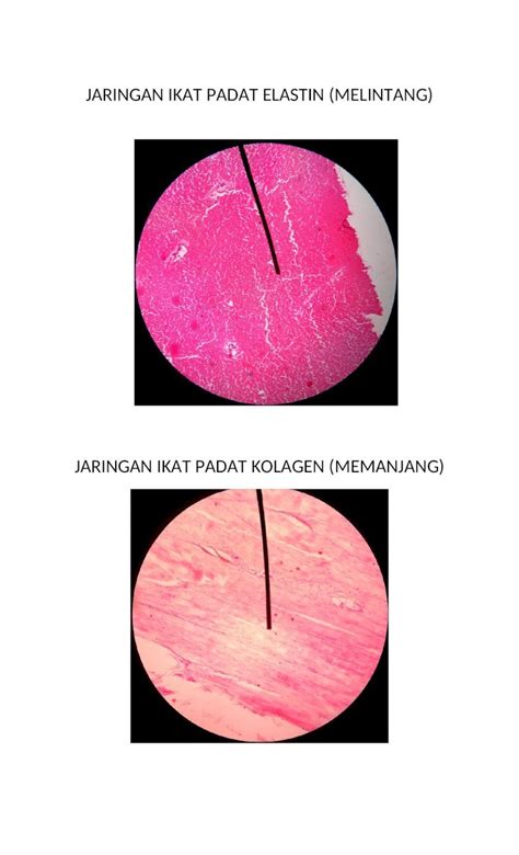 (DOC) JARINGAN IKAT PADAT ELASTIN1.doc - DOKUMEN.TIPS