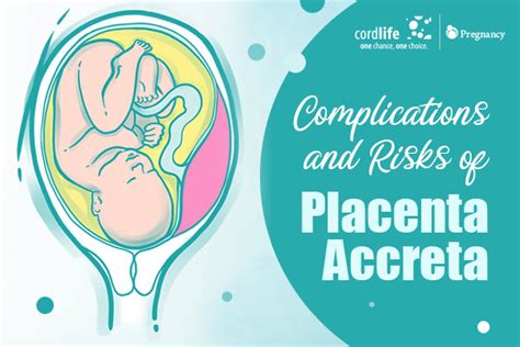 Complications and Risks of Placenta Accreta - Cordlife India