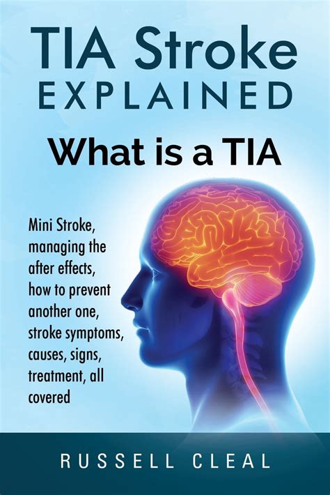 Tia Stroke Explained : What is a Tia, Mini Stroke, managing the after effects, how to prevent ...