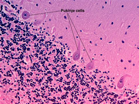 Purkinje Cells Histology