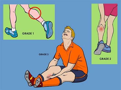 Calf Strain Symptoms - Muscle Pull | Muscle Pull