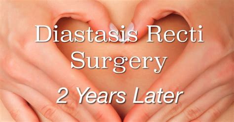 Diastasis Recti Surgery Update: 2 years later - it's a love/love thing | Diastasis recti ...